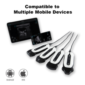 SonoEye P6